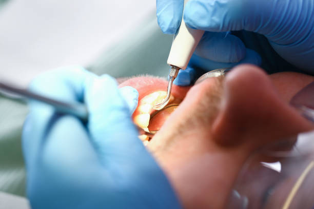 Best Emergency Dental Services for Seniors in Pasadena Hills, FL
